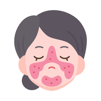 蛛状静脉